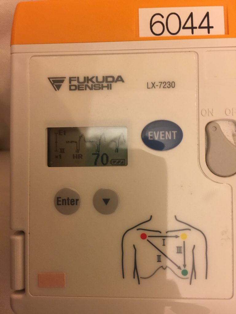 monatóireacht a dhéanamh ar electrocardiogram pulse 70